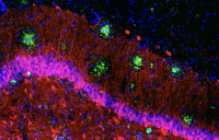 A hippocampal tissue section from Alzheimer's model in mouse showing amyloid plaques in green, surrounded by red neurons derived from experimentally activated neural stem cells, and blue-stained nuclear structures. From Kizil Lab, CUIMC.